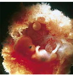 Imagen de un feto humano, a las pocas semanas de embarazo