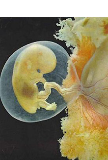 Imagen de un feto humano durante el embarazo